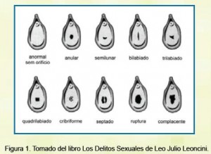 Antes y despues de los esteroides fotos